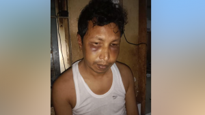 চোর দাবি করে শিক্ষককে বেঁধে পেটাল বখাটেরা