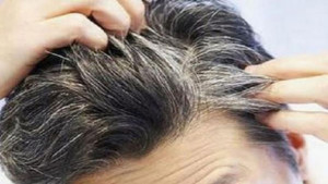 অল্প বয়সেই চুল পেকে যাচ্ছে?