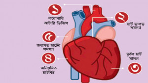 মানসিক চাপ থেকে হৃদরোগ