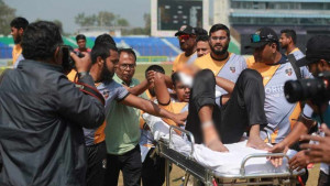 মাথায় আঘাত পেয়ে হাসপাতালে মোস্তাফিজ, চলছে সিটি স্ক্যান