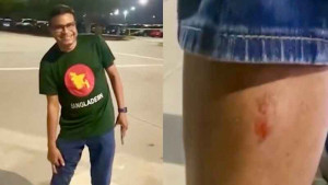 ছক্কা পায়ে লেগে ক্ষত, সমবেদনা জানালেন হৃদয় 