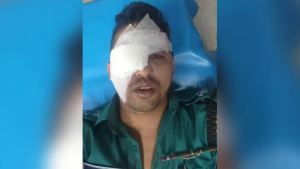 হিজড়াদের হামলায় চোখ হারালেন এসআই