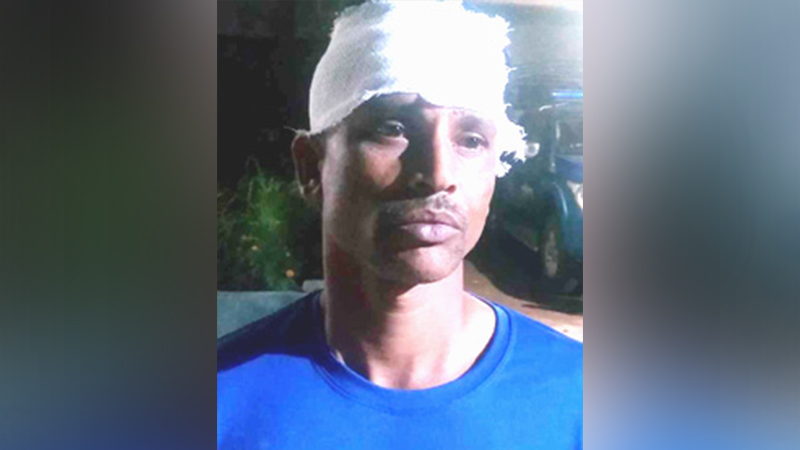 উত্ত্যক্তের প্রতিবাদ করায় ৩ ভাইবোনকে পেটাল বখাটেরা উত্ত্যক্তের প্রতিবাদ করায় ৩ ভাইবোনকে পেটাল বখাটেরা
