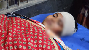 কিস্তি না পাওয়ায় নারী গ্রাহকের মাথা ফাঁটানোর অভিযোগ