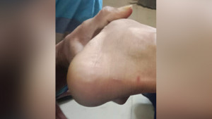 দংশনের পর সাপ ধরে নিয়ে হাসপাতালে এলেন রোগীর স্বজনরা