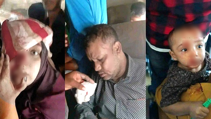 মহাখালীতে শিক্ষার্থীদের ইট-পাটকেলে রক্তাক্ত ট্রেনযাত্রী মহাখালীতে শিক্ষার্থীদের ইট-পাটকেলে রক্তাক্ত ট্রেনযাত্রী
