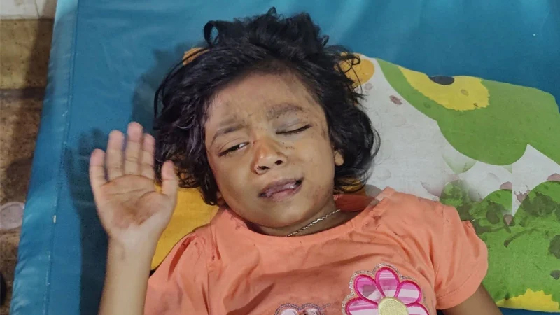 আরাধ্যর শারীরিক অবস্থা উন্নতির দিকে, আজ পায়ে অস্ত্রোপচার আরাধ্যর শারীরিক অবস্থা উন্নতির দিকে, আজ পায়ে অস্ত্রোপচার