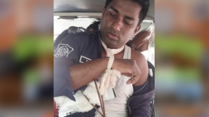 ব্যবসায়িক দ্বন্দ্বে সংঘর্ষ, পুলিশসহ টেঁটাবিদ্ধ ৬