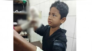 ময়লার স্তূপে পাওয়া সাউন্ড গ্রেনেডে বিচ্ছিন্ন শিশুর হাত 
