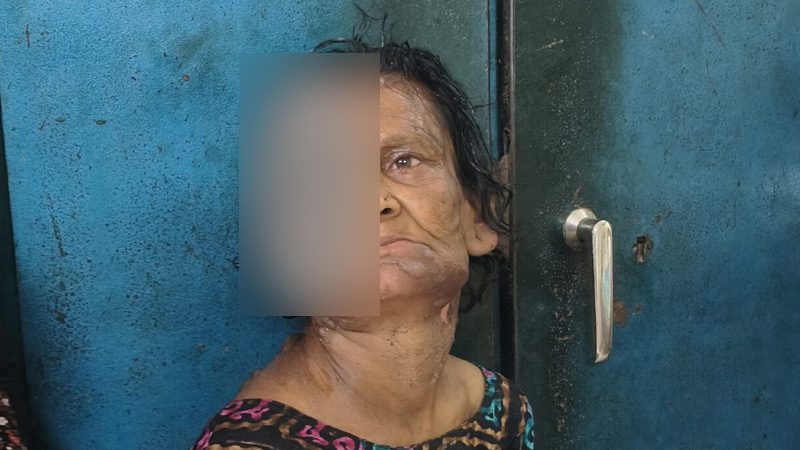 সত্তরোর্ধ্ব মানসিক প্রতিবন্ধী বৃদ্ধার মুখসহ শরীরে গরম পানি নিক্ষেপ সত্তরোর্ধ্ব মানসিক প্রতিবন্ধী বৃদ্ধার মুখসহ শরীরে গরম পানি নিক্ষেপ