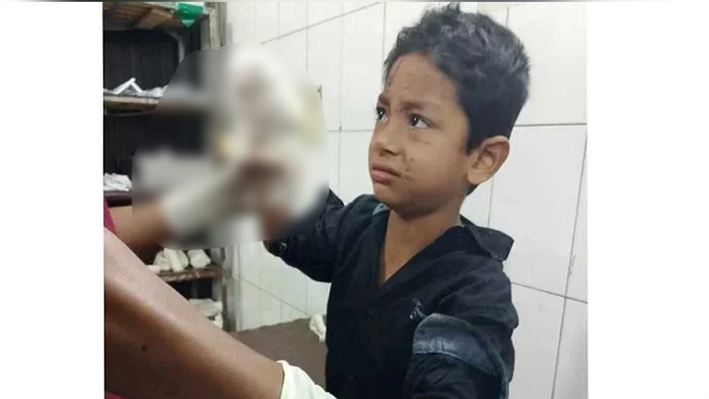 ময়লার স্তূপে পাওয়া সাউন্ড গ্রেনেডে বিচ্ছিন্ন শিশুর হাত ময়লার স্তূপে পাওয়া সাউন্ড গ্রেনেডে বিচ্ছিন্ন শিশুর হাত