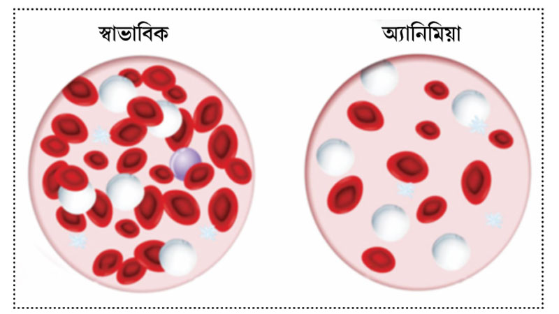 রক্তশূন্যতা কেন হয়? রক্তশূন্যতা কেন হয়?