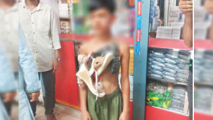 চুরির অভিযোগে শিশুর  গলায় জুতার মালা
