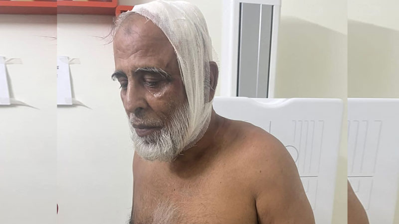 কৃষক দল নেতার ওপর বিএনপি নেতাকর্মীর হামলার অভিযোগ কৃষক দল নেতার ওপর বিএনপি নেতাকর্মীর হামলার অভিযোগ