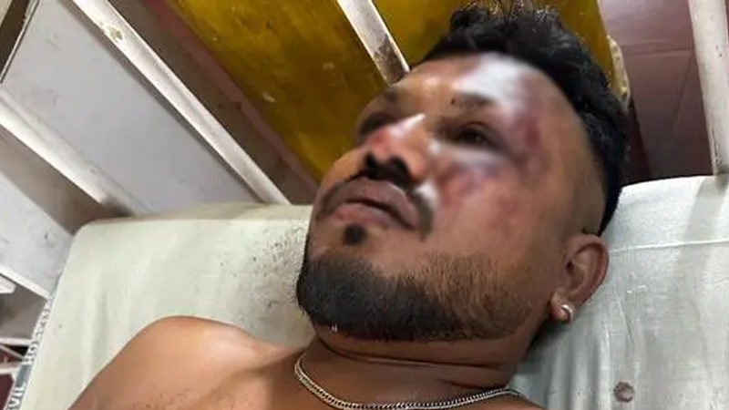 বিধ্বস্ত উড়োজাহাজের এক যাত্রীকে জীবিত উদ্ধার বিধ্বস্ত উড়োজাহাজের এক যাত্রীকে জীবিত উদ্ধার
