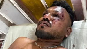 ‘ওড়ার ৩০ সেকেন্ডের মধ্যে জোরে আওয়াজ হয়, বিমানটি ভেঙে পড়ে’