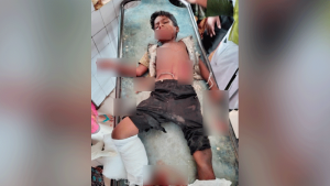 কুড়িয়ে পাওয়া ককটেল বিস্ফোরণে এক বোন নিহত, আহত অন্য ২ ভাইবোন