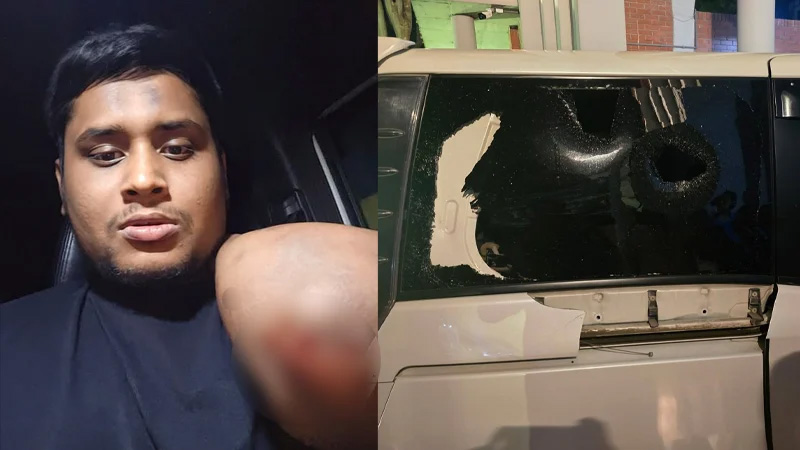হাসনাতের ওপর হামলা ও কিছু প্রশ্ন হাসনাতের ওপর হামলা ও কিছু প্রশ্ন