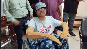 ৩৬ বার অস্ত্রোপচারের পর বাড়ি ফেরা