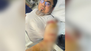 ক্যানসার হাসপাতালের উপ-পরিচালককে কুপিয়ে জখম