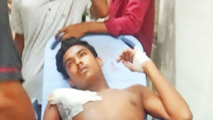 আহতদের বিদেশে চিকিৎসা নিয়ে জটিলতা