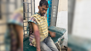 প্রতিবন্ধী যুবককে খুঁটিতে বেঁধে মারধর, দুই হাত এসিডে ঝলসে দেওয়ার অভিযোগ
