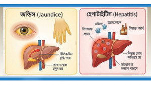 জন্ডিস মানেই হেপাটাইটিস নয়