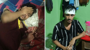 কাপ্তাইয়ের সুইডেন পলিটেকনিকে দুই পক্ষের সংঘর্ষ, আহত ১১