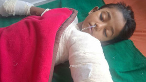 শিশু নিহানের বাম হাতটি কেটেই ফেলতে হলো