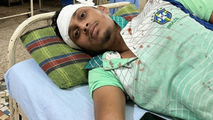 আর্জেন্টিনা সমর্থকদের হামলায় ব্রাজিল সমর্থক আহত