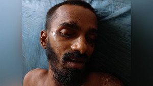 কে এই রোগী