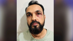 কেআইবি চত্বরে জুনিয়র কর্মকর্তার ঘুষিতে রক্তাক্ত সিনিয়র কর্মকর্তা