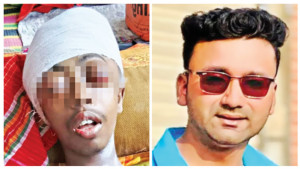 কিশোরকে নিষ্ঠুর নির্যাতন, নিভছে চোখের আলো