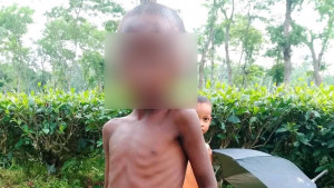 পুষ্টিহীনতা, রোগে-শোকে ভুগছে  চা বাগানের নতুন প্রজন্ম