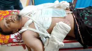 দুই পরিবারের ভিন্ন ভাষ্য তদন্ত করছে পুলিশ