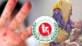 টিকাদানের দুই মাস পরও  কমছে না সংক্রমণ