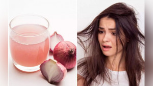 পেঁয়াজের রস ব্যবহারে কি চুল পড়া কমে? 