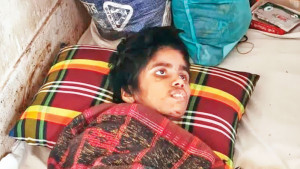 ছোট্ট শরীরজুড়ে বড় বড় ক্ষত