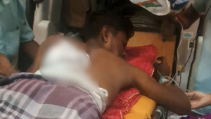 পার্কে তরুণ-তরুণীর মদ্যপানে বাধা, কুপিয়ে জখম যুবক