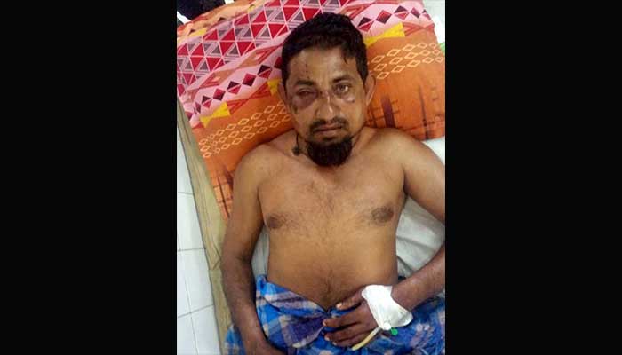 দুর্বৃত্তের হামলায় চোখ হারাতে বসেছেন ভ্যানচালক