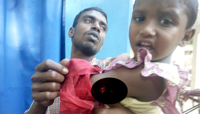 ৩২ জনকে কামড়ালো একটি কুকুর