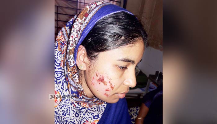 নোয়াখালীতে স্বামীর খুন্তির ছ্যাঁকায় ক্ষতবিক্ষত গৃহবধূ