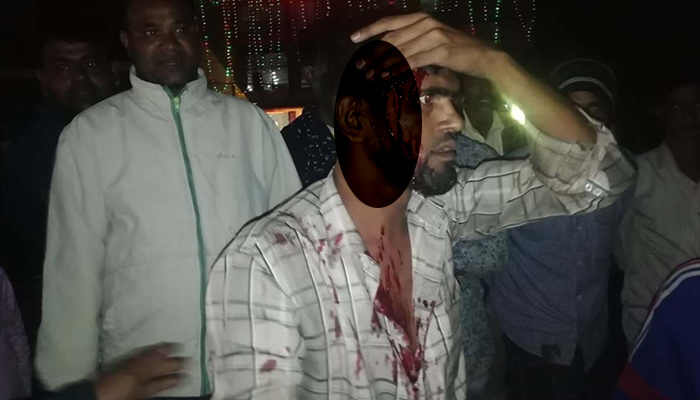 কর্ণফুলীতে পিটিয়ে ট্রাকচালকের মাথা ফাটালেন আনসার সদস্যরা
