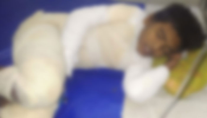 ফকিরাপুলে পথশিশুর গায়ে আগুন: জড়িতদের গ্রেপ্তারের নির্দেশ