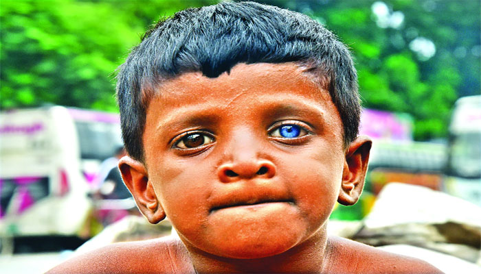 এক চোখ ধূসর অন্য চোখ নীল