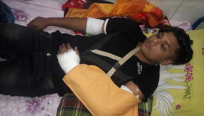 হাতুড়ি দিয়ে পিটিয়ে কলেজছাত্রের হাত ভাঙার অভিযোগ ছাত্রলীগ নেতার বিরুদ্ধে