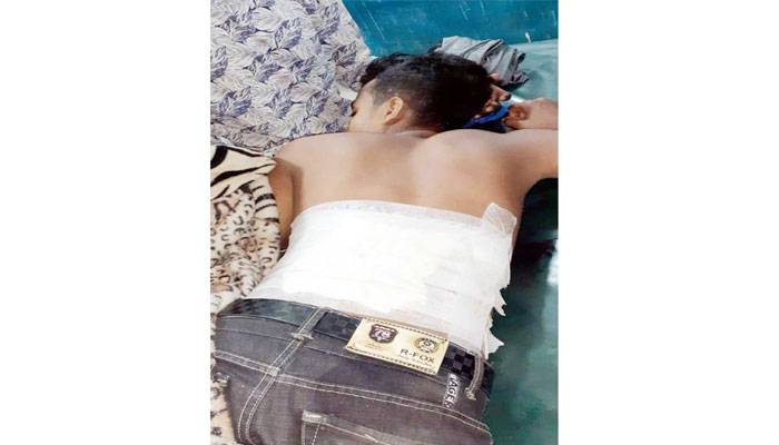 নোয়াখালীতে স্কুলছাত্রকে সহপাঠীর গুলি
