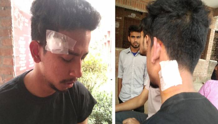 ফ্যান বন্ধ করা নিয়ে জাবি শিক্ষার্থীকে ছাত্রলীগ নেতার মারধর