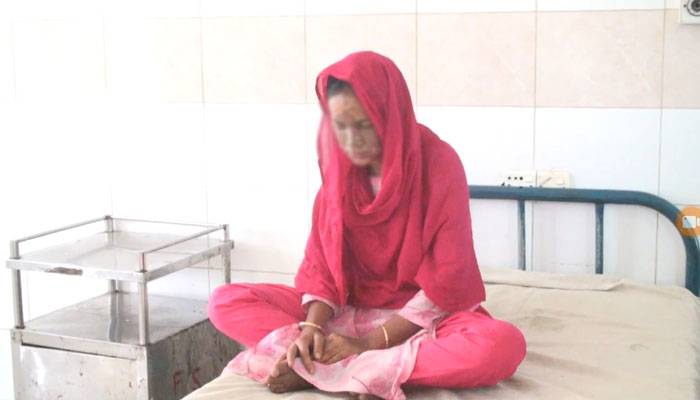 স্বামীর ছোড়া এসিডে ঝলসে গেল স্ত্রীর মুখ