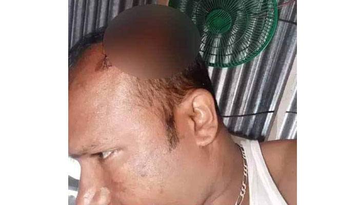 'হোম কোয়ারেন্টাইনে' থাকা ইতালি প্রবাসী সড়ক দুর্ঘটনায় আহত